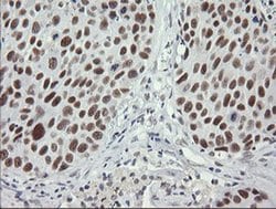 SESTD1 Monoclonal Antibody (OTI2E7), TrueMAB , OriGene 100 &mu;L; Unconjugated:Antibodies,