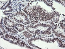 SESTD1 Monoclonal Antibody (OTI2E7), TrueMAB , OriGene 100 &mu;L; Unconjugated:Antibodies,