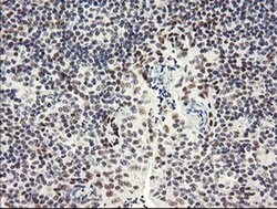 SESTD1 Monoclonal Antibody (OTI2E7), TrueMAB , OriGene 100 &mu;L; Unconjugated:Antibodies,