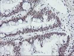 SESTD1 Monoclonal Antibody (OTI2E7), TrueMAB , OriGene 100 &mu;L; Unconjugated:Antibodies,