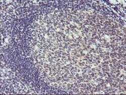 SESTD1 Monoclonal Antibody (OTI4B10), TrueMAB , OriGene 100 &mu;L; Unconjugated:Antibodies,