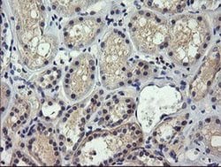 SESTD1 Monoclonal Antibody (OTI4B10), TrueMAB , OriGene 100 &mu;L; Unconjugated:Antibodies,