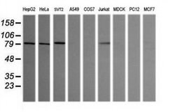 SESTD1 Monoclonal Antibody (OTI2E7), TrueMAB , OriGene 100 &mu;L; Unconjugated:Antibodies,