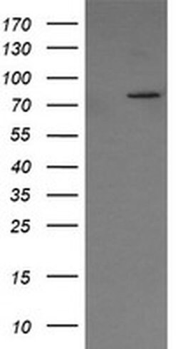 SESTD1 Monoclonal Antibody (OTI4B10), TrueMAB , OriGene 100 &mu;L; Unconjugated:Antibodies,