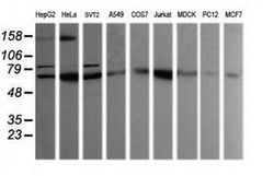 SESTD1 Monoclonal Antibody (OTI4B10), TrueMAB , OriGene 100 &mu;L; Unconjugated:Antibodies,