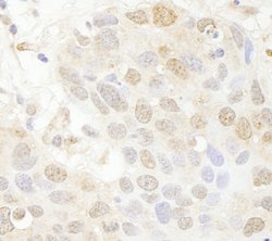 SET7 Polyclonal Antibody, Bethyl Laboratories 100 &mu;L; Unconjugated:Antibodies,