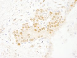 SET7 Polyclonal Antibody, Bethyl Laboratories 100 &mu;L; Unconjugated:Antibodies,