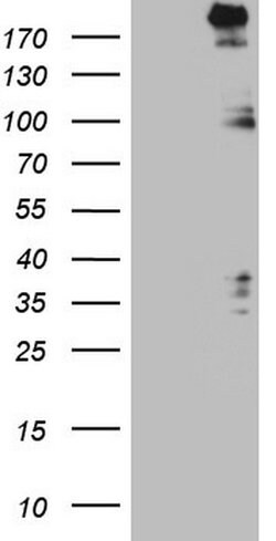 SETD1A Monoclonal Antibody (OTI1D3), TrueMAB , OriGene 30 &mu;L; Unconjugated:Antibodies,