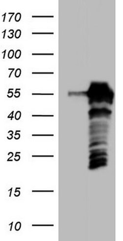 SETD2 Monoclonal Antibody (OTI1B4), TrueMAB , OriGene 100 &mu;L; Unconjugated:Antibodies,