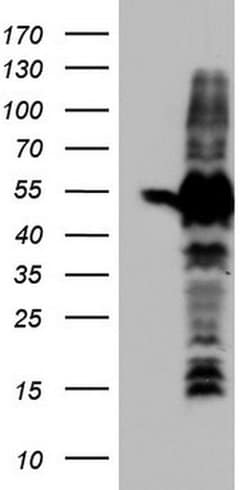 SETD2 Monoclonal Antibody (OTI3G8), TrueMAB , OriGene 100 &mu;L; Unconjugated:Antibodies,