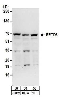 SETD3 Rabbit anti-Human, Polyclonal, Bethyl Laboratories 100 &mu;L; Unconjugated:Antibodies,