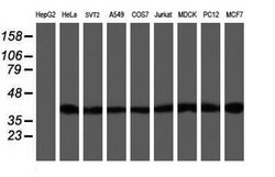 SETD7 Mouse anti-Canine, Human, Mouse, Rat, Clone: OTI2D10, lyophilized, TrueMAB 100 &mu;g | Buy Online | OriGene | Fisher Scientific