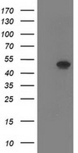 SETD7 Monoclonal Antibody (OTI5B11), TrueMAB , OriGene 100 &mu;L; Unconjugated:Antibodies,