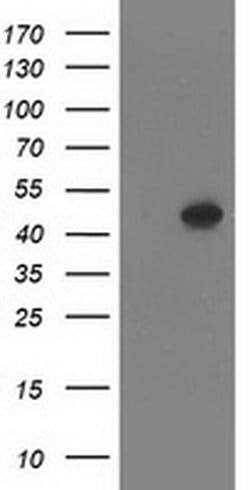 SETD7 Monoclonal Antibody (OTI2E3), TrueMAB , OriGene 100 &mu;L; Unconjugated:Antibodies,