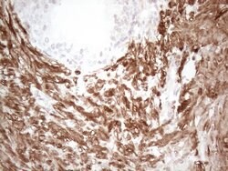 SETD8 Monoclonal Antibody (OTI3G9), TrueMAB , OriGene 100 &mu;L; Unconjugated:Antibodies,