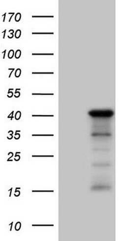 SETD8 Monoclonal Antibody (OTI3G9), TrueMAB , OriGene 100 &mu;L; Unconjugated:Antibodies,