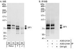 SF1 Rabbit anti-Human, Mouse, Polyclonal, Bethyl Laboratories 100 &mu;L;