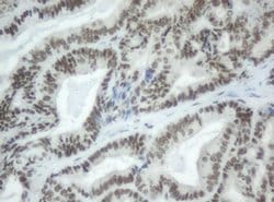 SF3A1 Monoclonal Antibody (OTI4D8), TrueMAB , OriGene 100 &mu;L; Unconjugated:Antibodies,