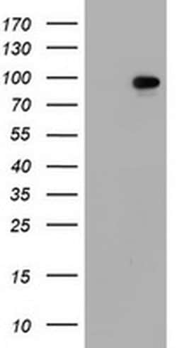 SF3A1 Monoclonal Antibody (OTI1B5), TrueMAB , OriGene 100 &mu;L; Unconjugated:Antibodies,