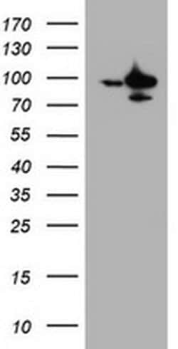 SF3A1 Monoclonal Antibody (OTI7G6), TrueMAB , OriGene 100 &mu;L; Unconjugated:Antibodies,