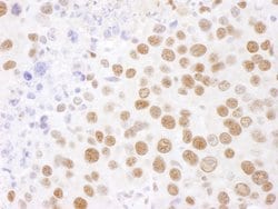 SF3B4 Rabbit anti-Human, Mouse, Polyclonal, Bethyl Laboratories 100 &mu;L;