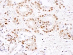 SF3B4 Rabbit anti-Human, Mouse, Polyclonal, Bethyl Laboratories 100 &mu;L;