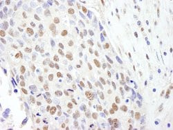 SF3b145/SAP145 Rabbit anti-Human, Polyclonal, Bethyl Laboratories 100 &mu;L;