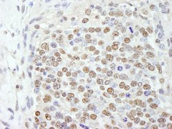 SF3b145/SAP145 Polyclonal Antibody, Bethyl Laboratories:Antibodies:Primary
