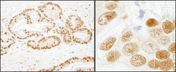 SF3b155/SAP155 Rabbit anti-Human, Polyclonal, Bethyl Laboratories 100 &mu;L;