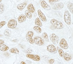 SF3b155/SAP155 Polyclonal Antibody, Bethyl Laboratories 100 &mu;L | Buy Online | Bethyl Laboratories, Inc | Fisher Scientific