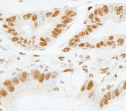 SF3b155/SAP155 Polyclonal Antibody, Bethyl Laboratories 100 &mu;L | Buy Online | Bethyl Laboratories, Inc | Fisher Scientific