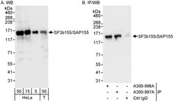 SF3b155/SAP155 Rabbit anti-Human, Polyclonal, Bethyl Laboratories 100 &mu;L;