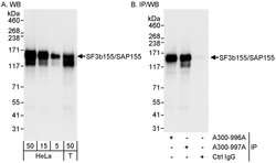 SF3b155/SAP155 Rabbit anti-Human, Polyclonal, Bethyl Laboratories 100 &mu;L;