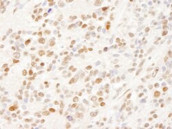 SFRS14 Rabbit anti-Human, Polyclonal, Bethyl Laboratories 100 &mu;L; Unconjugated:Antibodies,