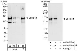 SFRS14 Rabbit anti-Human, Polyclonal, Bethyl Laboratories 100 &mu;L; Unconjugated:Antibodies,