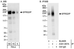 SFRS2IP Rabbit anti-Human, Polyclonal, Bethyl Laboratories 100 &mu;L; Unconjugated:Antibodies,