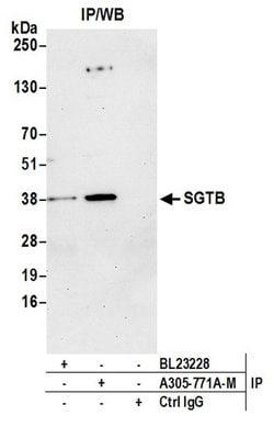SGTB Polyclonal Antibody, Bethyl Laboratories:Antibodies:Primary Antibodies