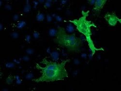 SH2B3 Monoclonal Antibody (OTI2B11), TrueMAB , OriGene 30 &mu;L; Unconjugated:Antibodies,