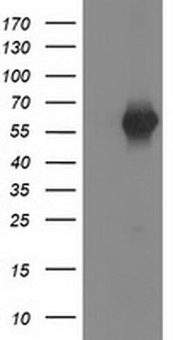 SH2B3 Monoclonal Antibody (OTI2B11), TrueMAB , OriGene 30 &mu;L; Unconjugated:Antibodies,