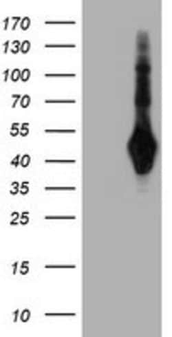 SH2D2A Mouse anti-Human, Mouse, Clone: OTI3C7, lyophilized, TrueMAB 100