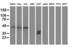 SH2D2A Mouse anti-Human, Mouse, Clone: OTI3C7, lyophilized, TrueMAB 100