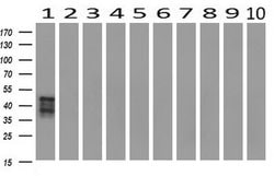 SH2D2A Mouse anti-Human, Mouse, Clone: OTI3C7, lyophilized, TrueMAB 100