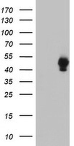 SH2D2A Monoclonal Antibody (OTI1B8), TrueMAB , OriGene 100 &mu;L; Unconjugated:Antibodies,