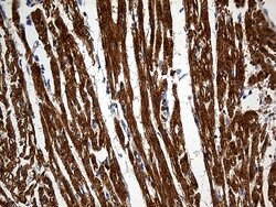 SH3BGR Monoclonal Antibody (OTI4G5), TrueMAB , OriGene 30 &mu;L; Unconjugated:Antibodies,