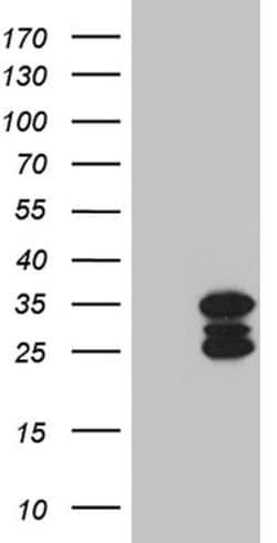 SH3BGR Monoclonal Antibody (OTI4G5), TrueMAB , OriGene 30 &mu;L; Unconjugated:Antibodies,