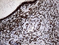 SH3BGRL Monoclonal Antibody (OTI8F7), TrueMAB , OriGene 100 &mu;L; Unconjugated:Antibodies,