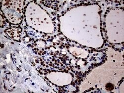 SH3BGRL Monoclonal Antibody (OTI8F7), TrueMAB , OriGene 100 &mu;L; Unconjugated:Antibodies,