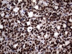 SH3BGRL Monoclonal Antibody (OTI8F7), TrueMAB , OriGene 100 &mu;L; Unconjugated:Antibodies,