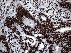 SH3BGRL Monoclonal Antibody (OTI8F7), TrueMAB , OriGene 100 &mu;L; Unconjugated:Antibodies,