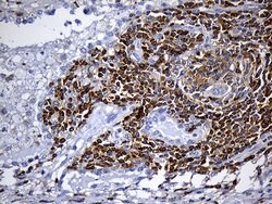 SH3BP1 Monoclonal Antibody (OTI2F4), TrueMAB , OriGene:Antibodies:Primary